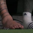 Tremenda lesión de Messi en el tobillo durante la Copa América se vuelve viral ¿Qué pasará con el futuro del jugador?